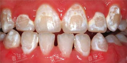 �����ѿ�ͼƬ