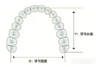 牙弓尺寸照片 牙弓尺寸照片
