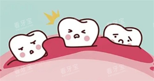 根尖囊肿表现 根尖囊肿表现