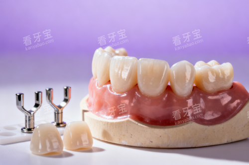 牙齿模型图片展示一览 牙齿模型图片展示一览