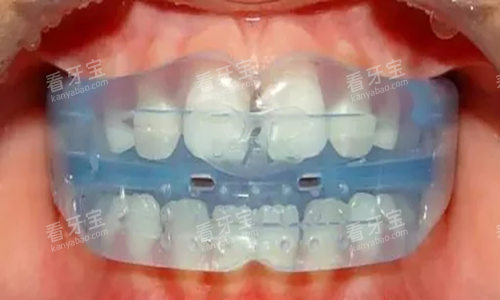 MRC��ͯ�������ڸ�Ԥ������