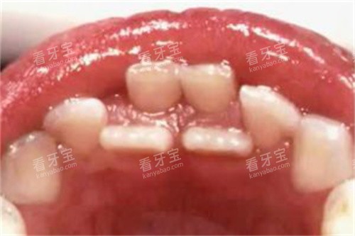 ��ͯ��������