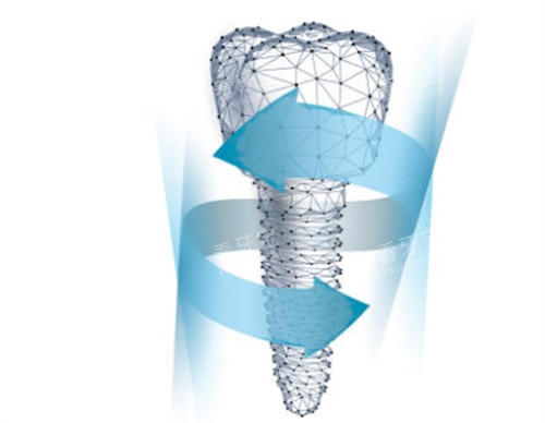 ��ֲ��ģ�Ϳ�ͨͼ