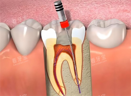 �������ƶ���չʾ