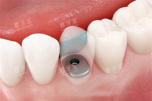 ��ֲ����ɺ�͸��