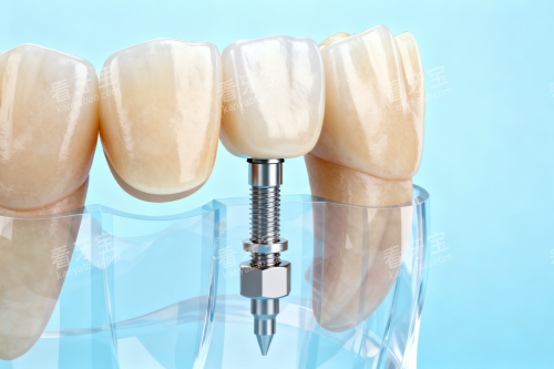 ��ֲ������������ǰ��Ա�ͼ