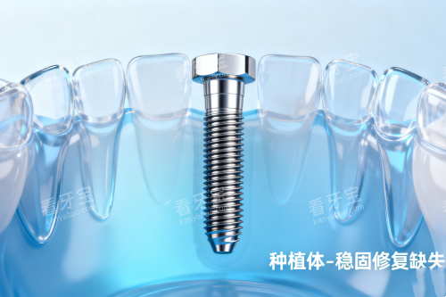 ��ֲ���޸�ֲ��չʾͼ