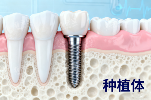 ��ֲ��ֲ���ǻչʾͼ