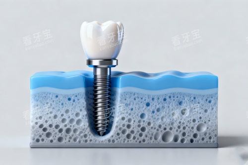 ������ֲ��ֲ���ǻչʾͼ