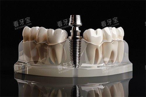 ��ֲ��ֲ������ʾ��ͼ