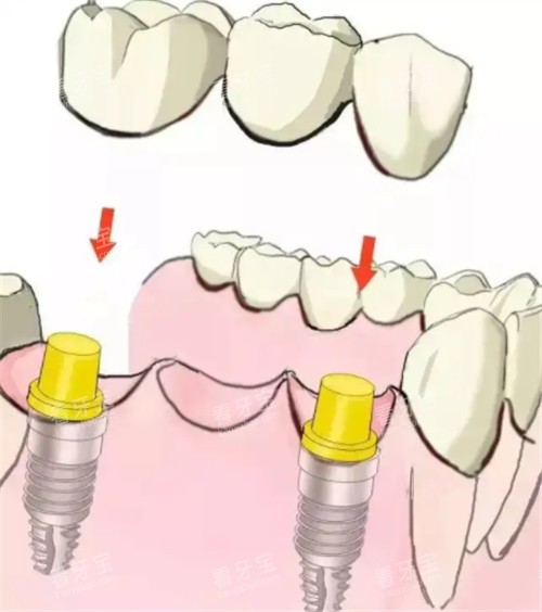 ֲ��������ڶ���ͼ