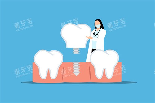 ��ֲ������ͼ