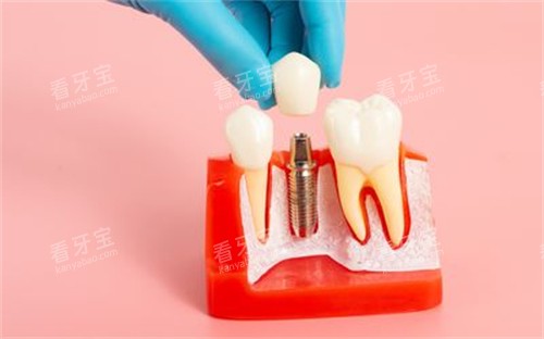 ��ֲ��ģ��չʾͼ