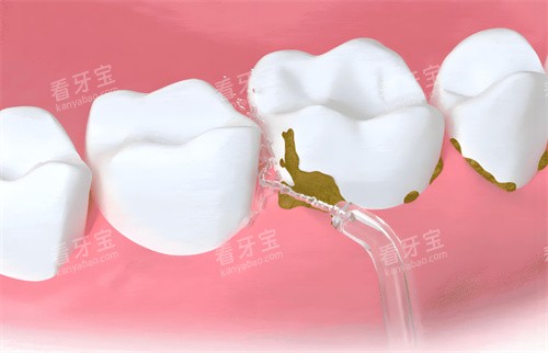 ϴ�����̿�ͨͼ