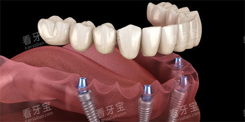 �����ֲ��ͼʾ