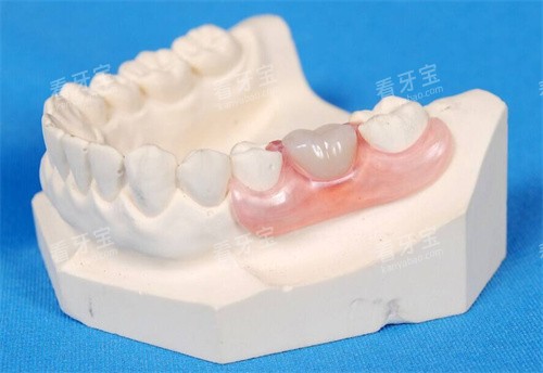 牙齿模型展示 图片 牙齿模型展示 图片