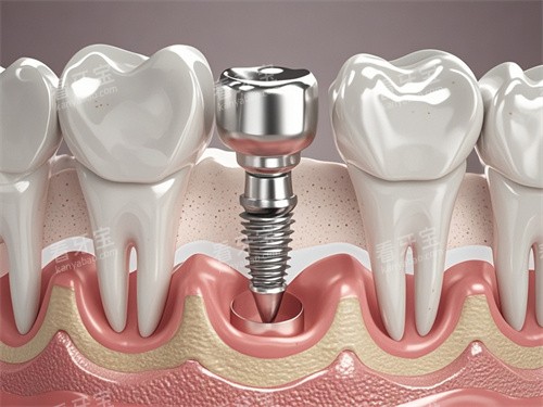 ��ֲ��ģ��ͼƬչʾ