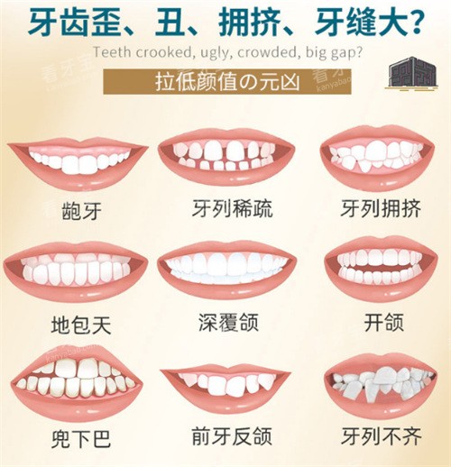 牙齿矫正适应症图示 牙齿矫正适应症图示