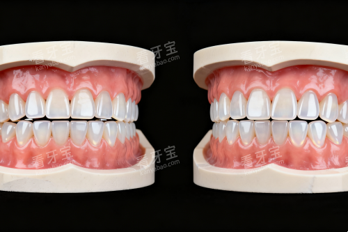 ����ģ��չʾͼ