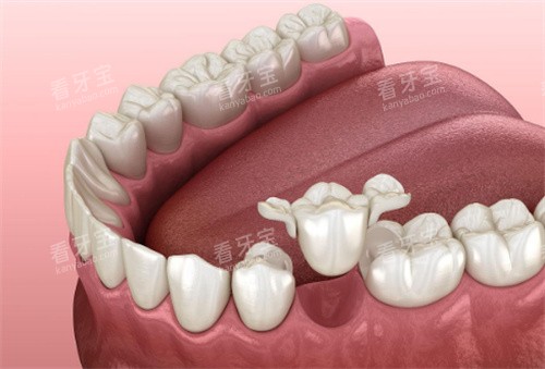 �����޸�����չʾͼ