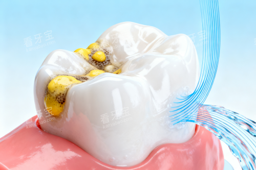 牙齿清洁卡通图 牙齿清洁卡通图