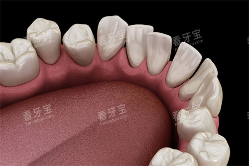 ���ݲ������ڲ��ӽ�