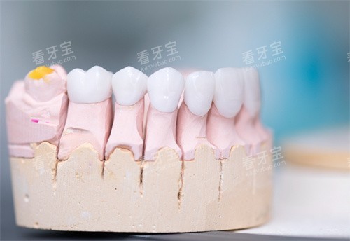 ����ģ��ͼչʾͼƬ