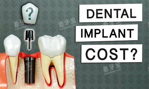 ʲô����ֲ��