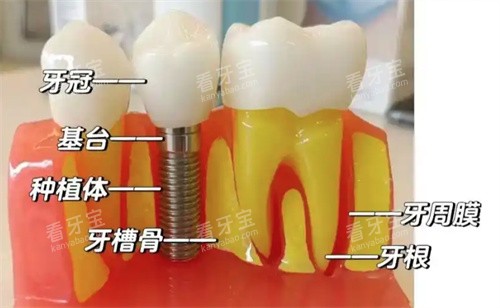 ��ֲ��ʵ�Ĺ���