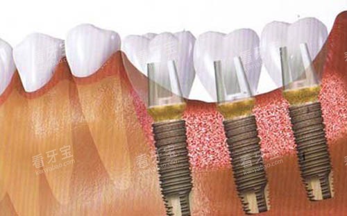 ��ֲ��������ͼ