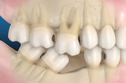 ����ȱһ�Ų���������Ӱ��ͼ