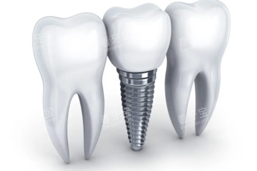 ��ֲ���������Ա�ͼ