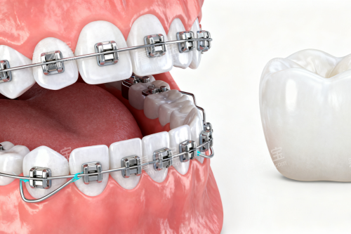 ���ݽ�����ͨչʾͼ