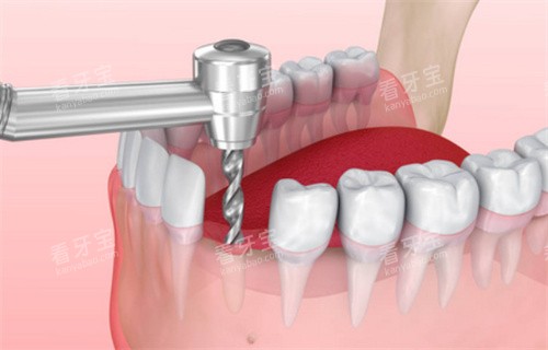 ��ֲ�����̶���չʾ