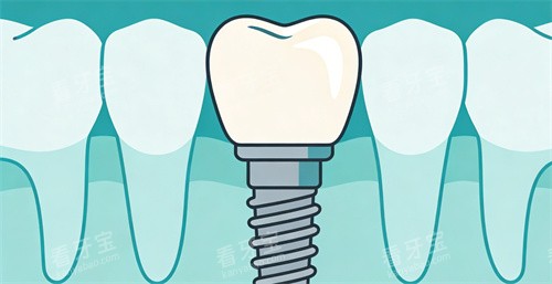 ��ֲ����ͨ��ֲչʾ��Ƭ