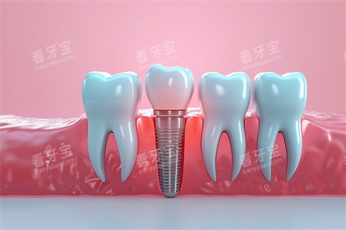 ��ֲ������ģ�ͽ���ͼ