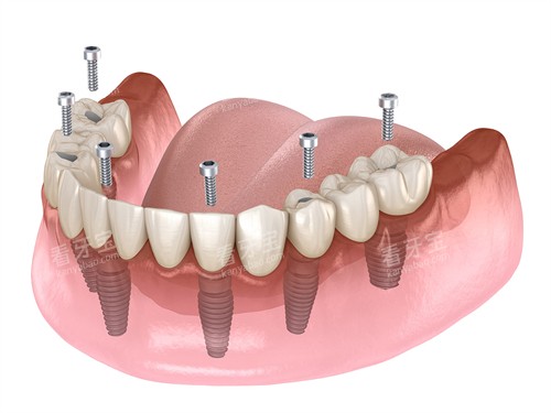 �����ֲ��ֲ��ͼ