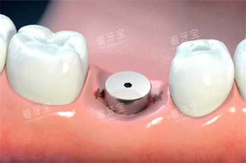 ������ֲ�����ϻ�̨