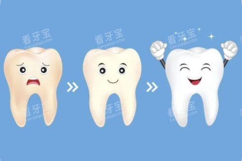 牙齿美白顺序图 牙齿美白顺序图