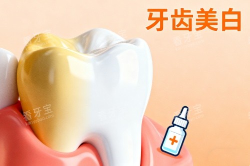 牙齿美白卡通图片展示 牙齿美白卡通图片展示