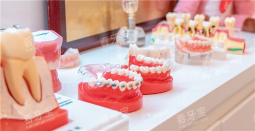 牙套牙模展示 牙套牙模展示