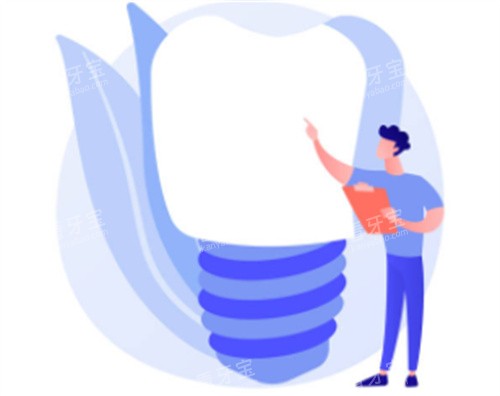 种植牙科普知识图 种植牙科普知识图