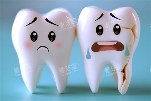 正常牙齿和牙齿发裂模型 正常牙齿和牙齿发裂模型