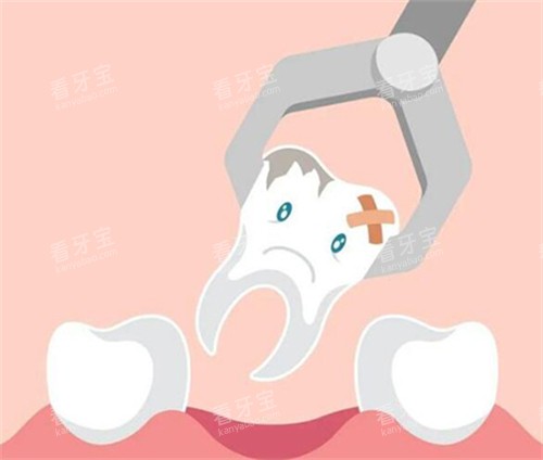 牙齿拔除卡通图 牙齿拔除卡通图