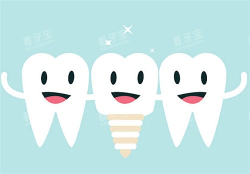 ��ֲ���ͽ�������ͼ