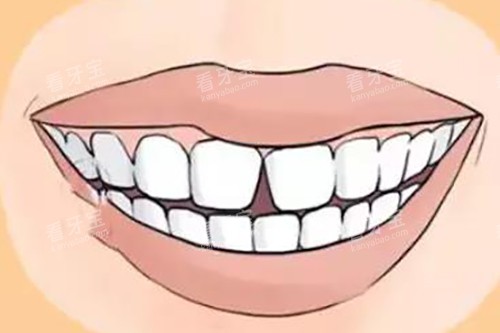 �����з쿨ͨʾ��ͼ