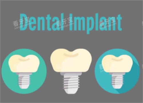 ��ֲ��Ӣ��