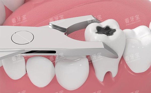 �����γ���Ƭ