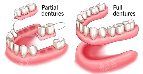 ��������