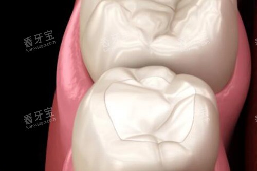 拔牙改善展示照片 拔牙改善展示照片